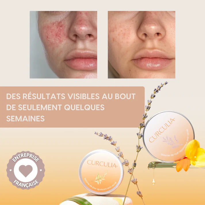 Baumes Apaisants Anti-Acné