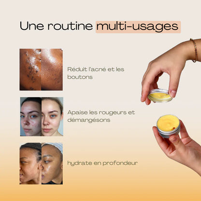 Baumes Apaisants Anti-Acné