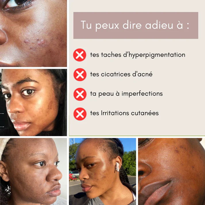 Pads Nettoyants au Curcuma 3 en 1