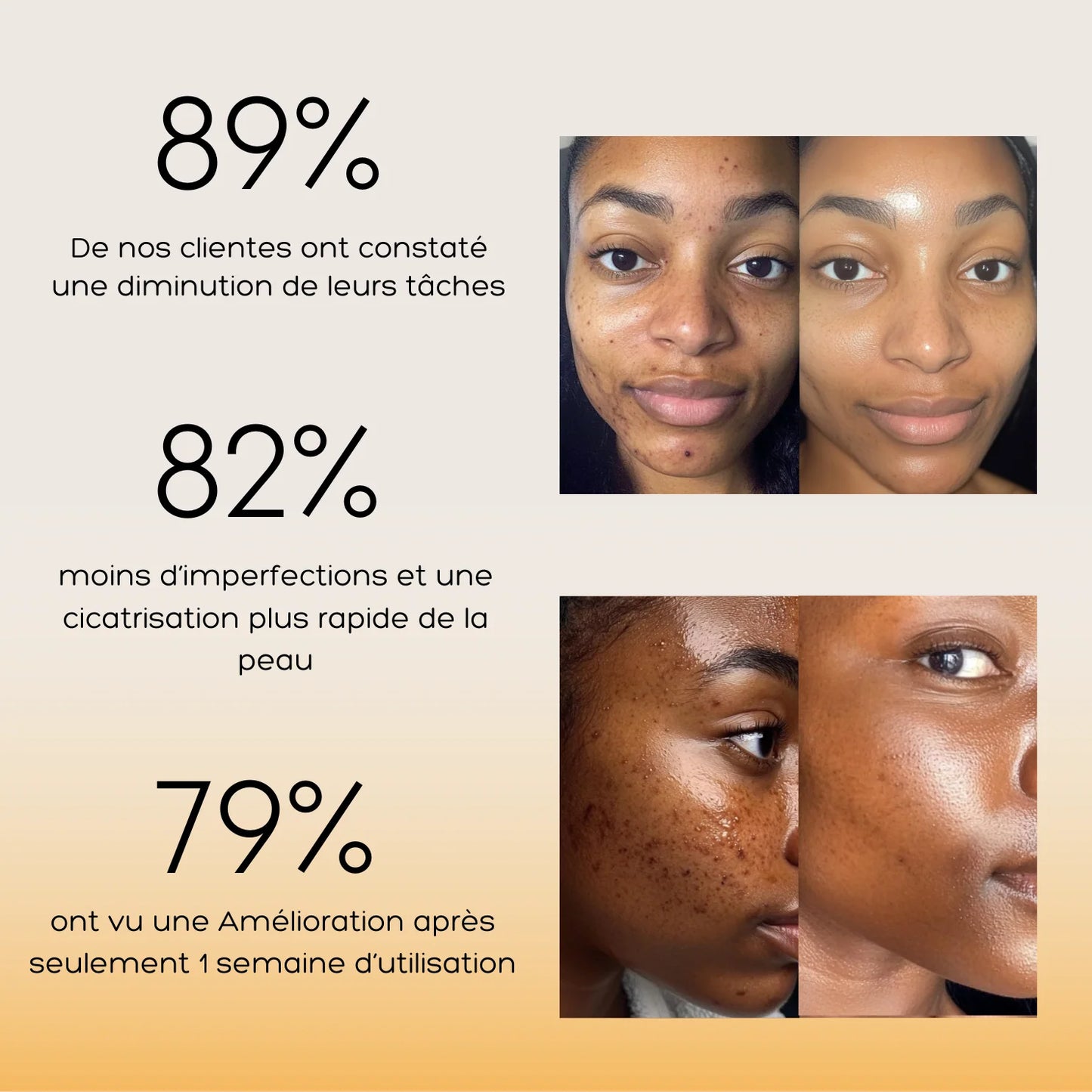 Routine Anti-Imperfections 4 en 1