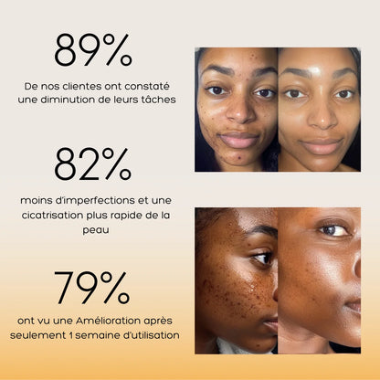 Routine Anti-Imperfections 4 en 1