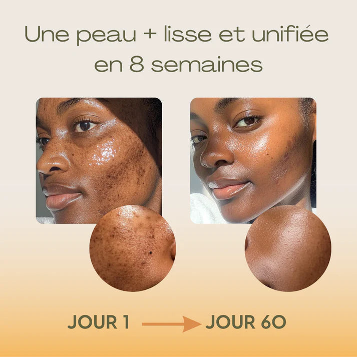 Routine Anti-Imperfections 4 en 1